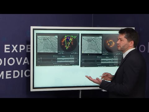 Left main and bifurcation stenting optimised by intracoronary imaging - Webinar