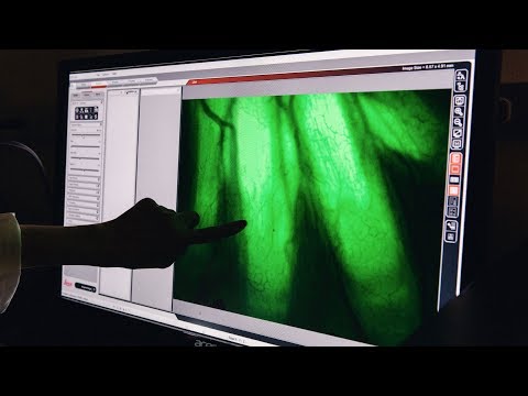 Jessica Whited on Limb Regeneration and the Axolotl Genome