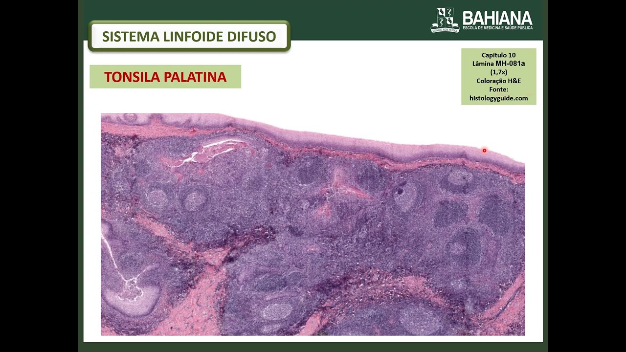Aula   Tecido Linfóide associado à mucosa