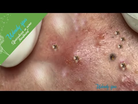 Make Your Day Relaxing with Windy Spa 6#136