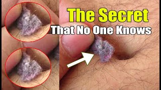 What&#39;s Inside Your Belly Button! The Secret that no one knows about belly botton fluff forms dangero
