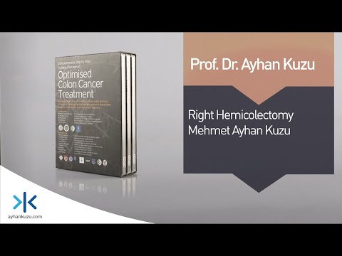 2.2.2. Right Hemicolectomy for Ascending Colon Carcinoma - Werner Hohenberger