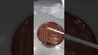 Download lagu Indole test for E.coli identification. #bacteria #ecoli #gramstaining #fyp #laboratory mp3 Download lagu Indole test for E.coli identification. #bacteria #ecoli #gramstaining #fyp #laboratory mp3