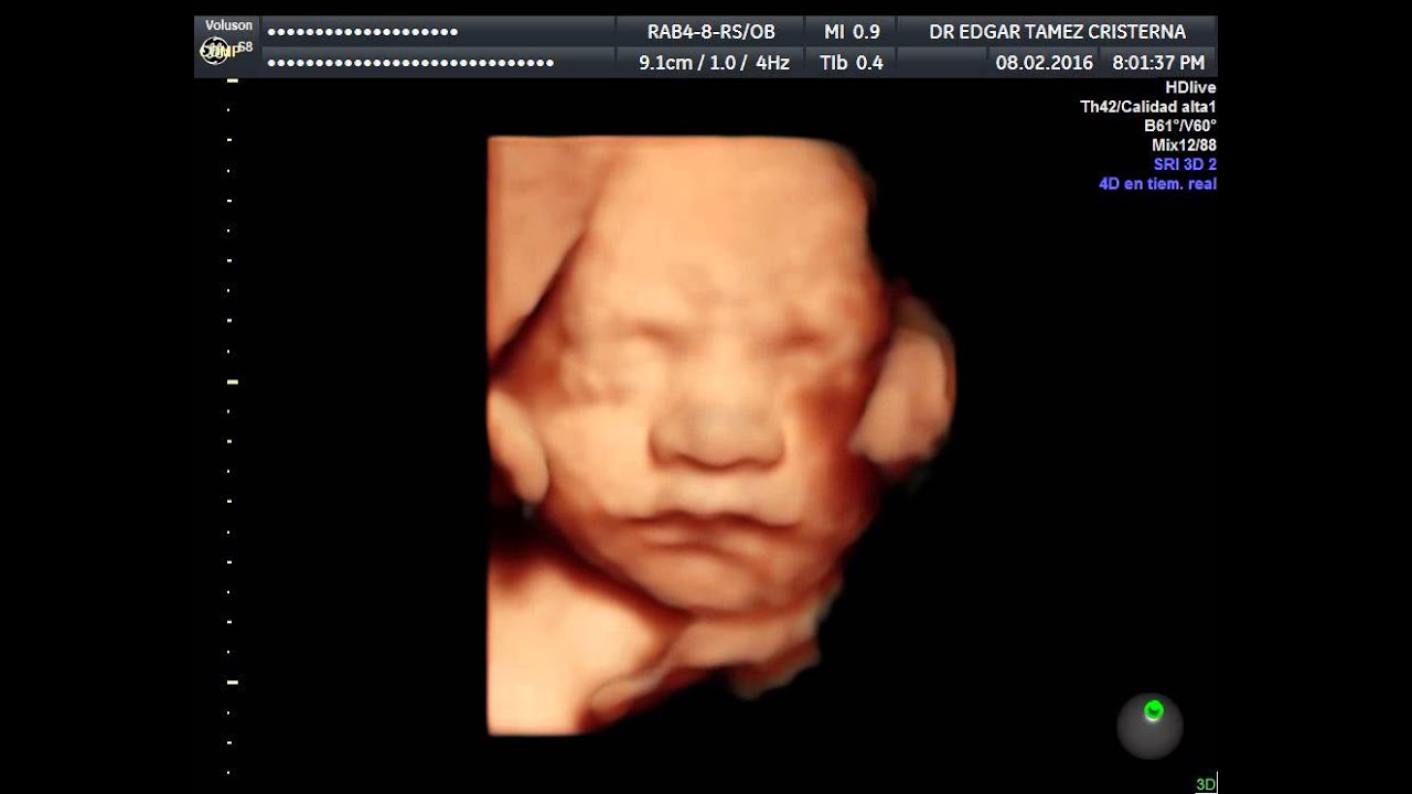 Edgar Alejandro Támez Cristerna-10