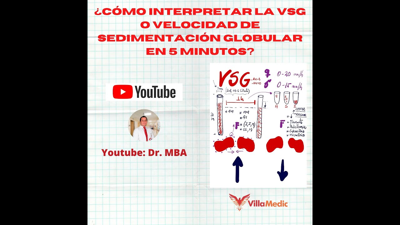 Watch ¿Cómo interpretar la VSG o velocidad de sedimentación globular Now ¿Cómo interpretar la VSG o velocidad de sedimentación globular