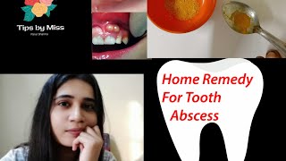TREAT GUM ABSCESS AT HOME (SELF TESTED)
