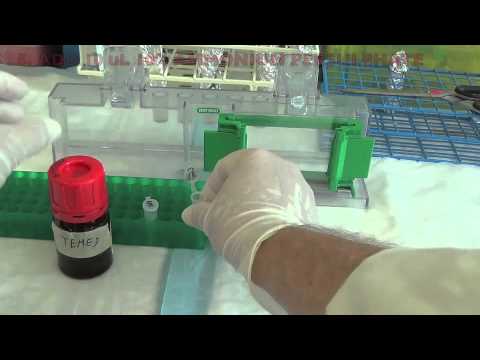 Preventig SDS-PAGE Gels From Leaking Using Stacking Gel