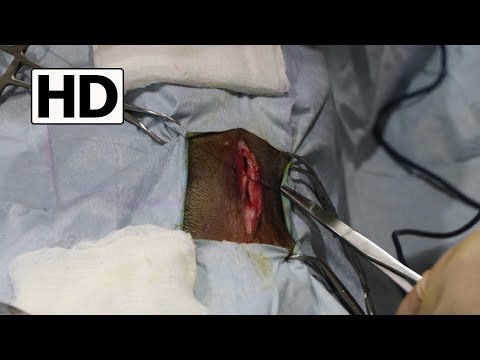 Umbilical Hernia Repair on a 10 Month Old Puppy