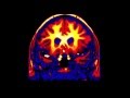 The Figgs "Connecting Brains" [Official Video]