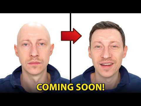 NEW Hair Loss Drug to Cure BALDNESS? | Treat Hair Loss