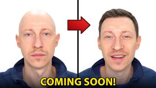 Download lagu NEW Hair Loss Drug to Cure BALDNESS? | Treat Hair Loss mp3