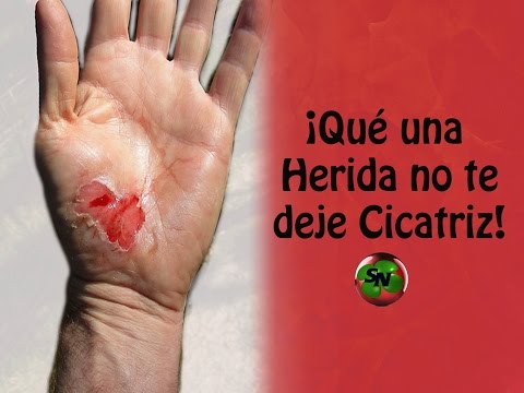 Evita que las heridas te dejen cicatrices