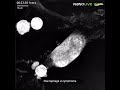 Macrophage Vs Lymphoma