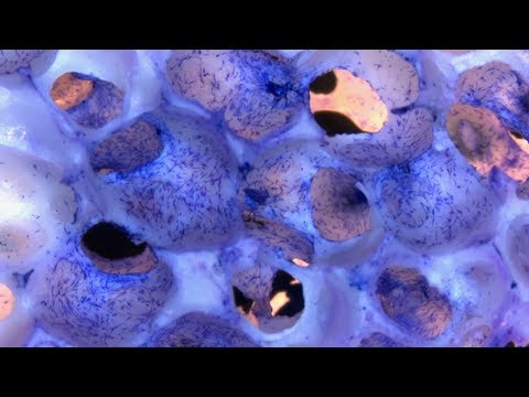 Anwendung Hirse Diabetes Das gibt Scheck an Insulin