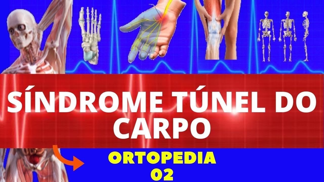 SÍNDROME DO TÚNEL DO CARPO (CAUSAS, SINTOMAS, DIAGNÓSTICO E TRATAMENTO) NERVO MEDIANO