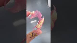 Download lagu Valplast flexible denture #dentallab #valplast #dentures #laboratory more info 601133462064 mp3 Download lagu Valplast flexible denture #dentallab #valplast #dentures #laboratory more info 601133462064 mp3