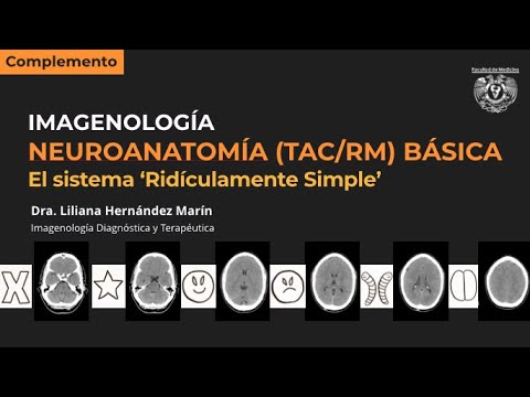 Neuroanatomía seccional básica (TAC y RM) - El sistema "ridículamente simple"