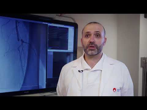 Sarcina după embolizarea fibromului uterin