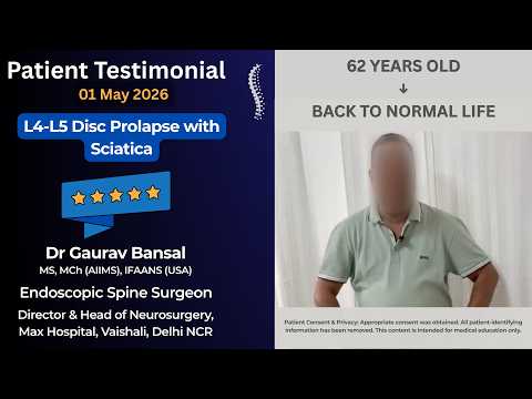 Severe Sciatica & Difficulty Walking | Recovery After UBE Spine Surgery