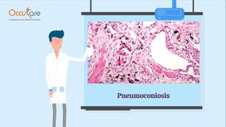 Pneumoconiosis: Causes, Symptoms, Diagnosis, and Treatment