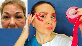 How To Get Rid of Puffy Eyes | Kinesiology Tape for Swelling Eyes and UNDER EYE BAGS
