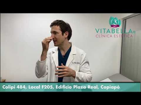 Dr. Diego Quispe, Cirugía  Plástica y Reconstructiva - Rinomodelación con Ácido Hialurónico.