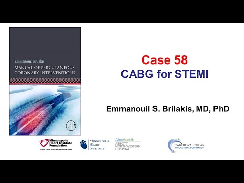 Case 58: PCI Manual - CABG for STEMI