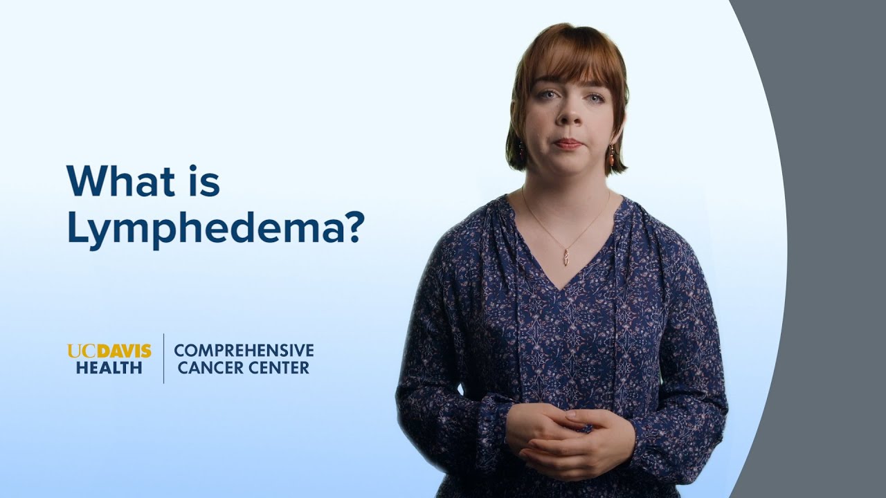 Thumbnail preview of What is Lymphedema? | UC Davis Comprehensive Cancer Center