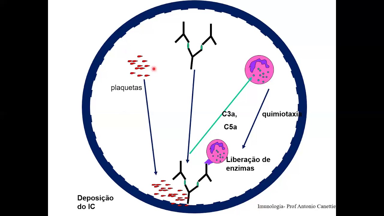 IMUNOLOGIA- Reação de hipersensibilidade tipo III