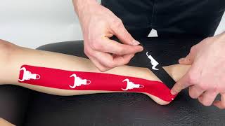 Kinesiology Taping for Medial Ankle Sprain