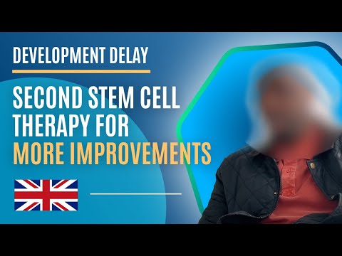 Miglioramenti: seconda terapia con cellule staminali per disturbi globali dello sviluppo
