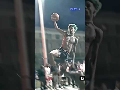 Worst injury in Basketball😥#shorts