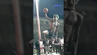 Worst injury in Basketball😥#shorts