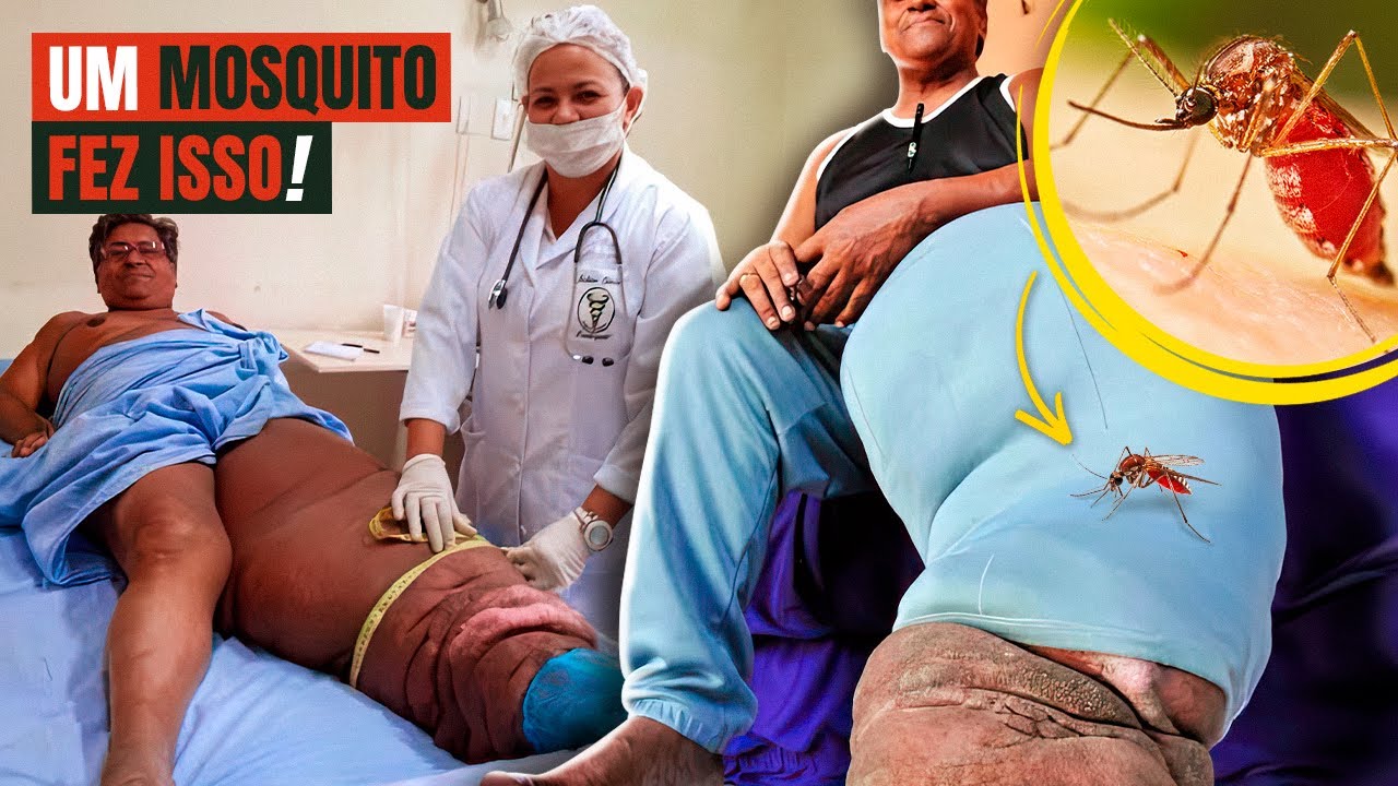 POR CAUSA DE UMA PICADA ESSE HOMEM TEVE UM FIM TRÁGICO