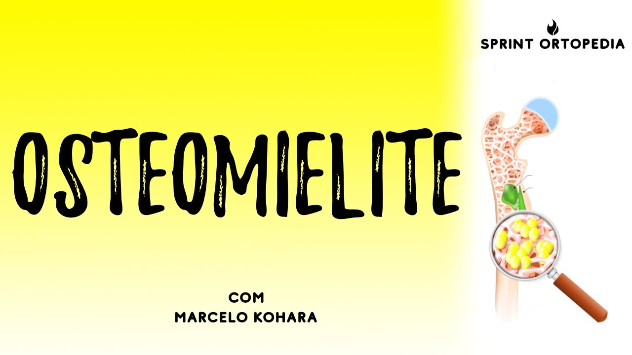 Osteomielite. Osteomielite para o TEOT