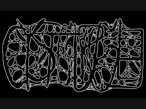 Cystgurgle - Fermentation through Surgical Interruption