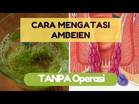 Kelompok torus dan ulasan Apa yang terjadi pada anak perempuan ketika mereka bersemangat