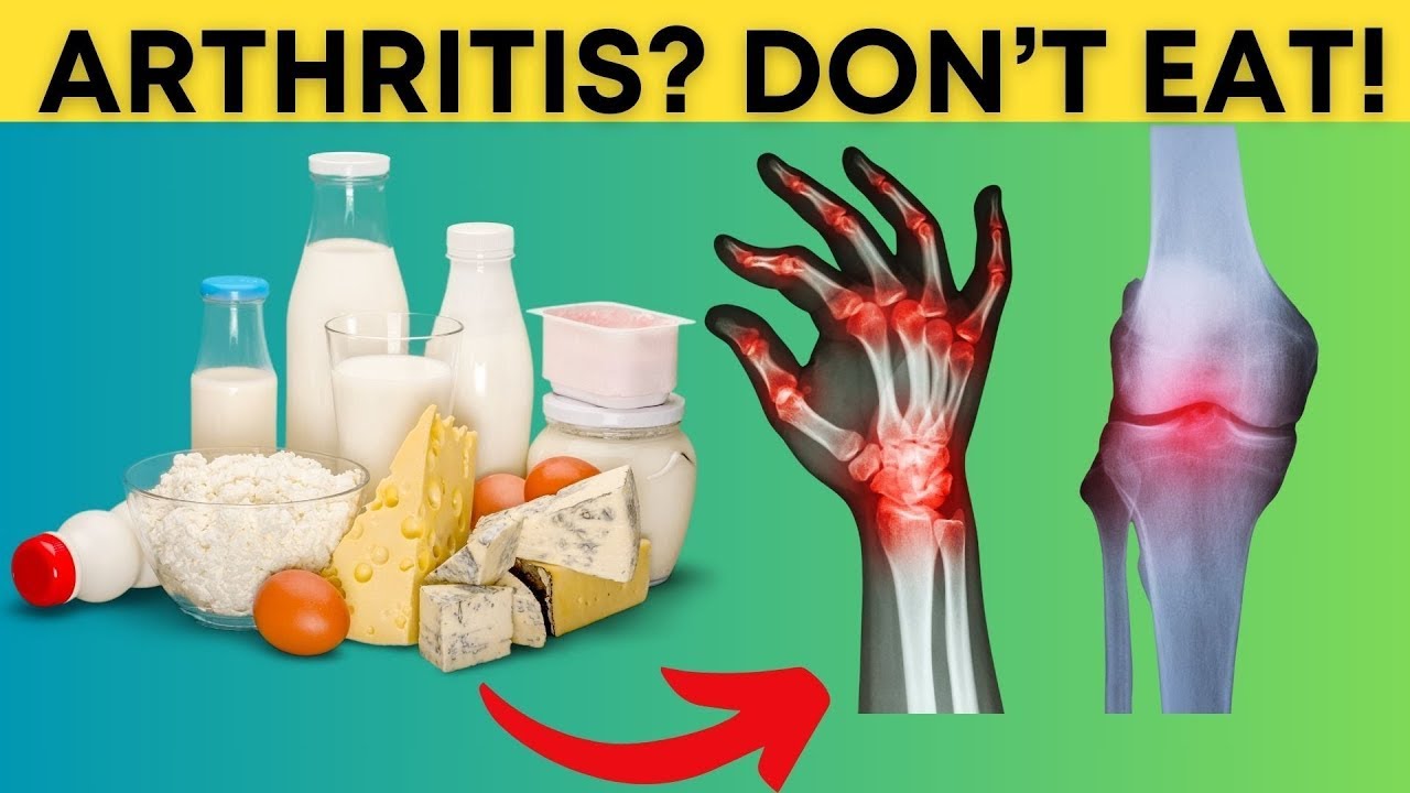 9 Foods To Avoid If You Have Arthritis Stop Now