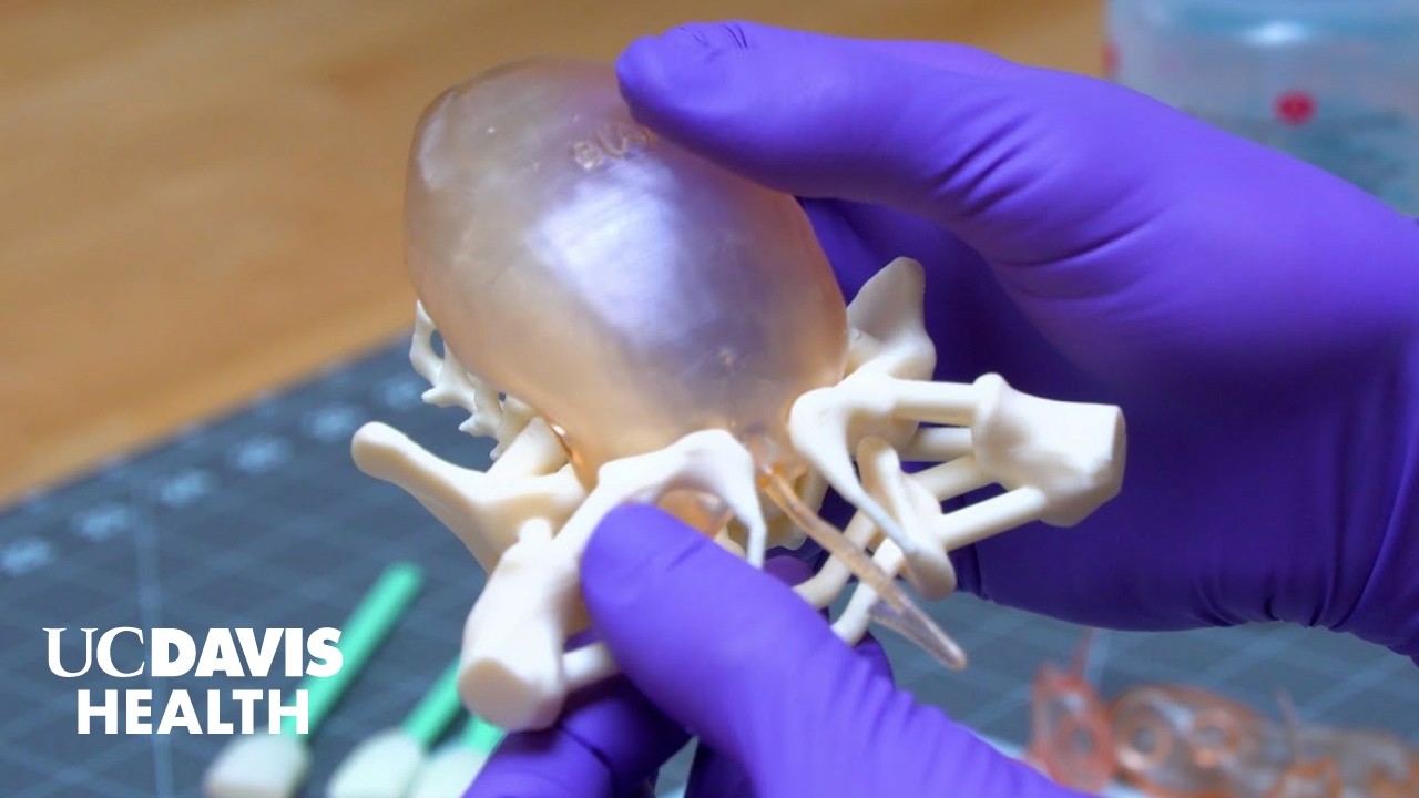 Thumbnail preview of 3D Printed Models Provide Road Map to Rare Cloacal Repair Surgeries