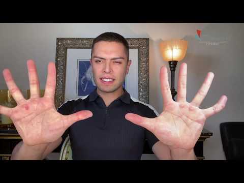 Fisioterapia en Casa | Ejercicios de mano para la artritis