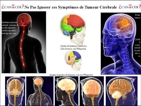 , title : 'Ne Pas Ignorer ces Symptômes des Tumeurs du Cerveau'