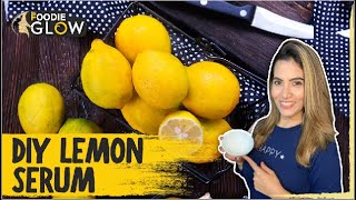 DIY Lemon Serum For Stretch Marks | How To Remove Stretch Marks | The Foodie Glow