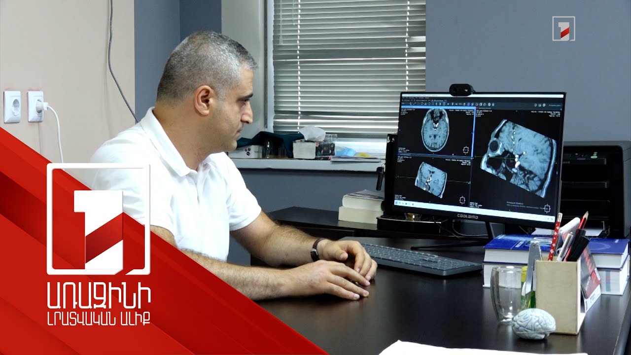 Մարզերում 300 բժշկի պակաս կա. նպատակային տեղերի ընդունելությունը մինչև սեպտեմբերի 10-ն է