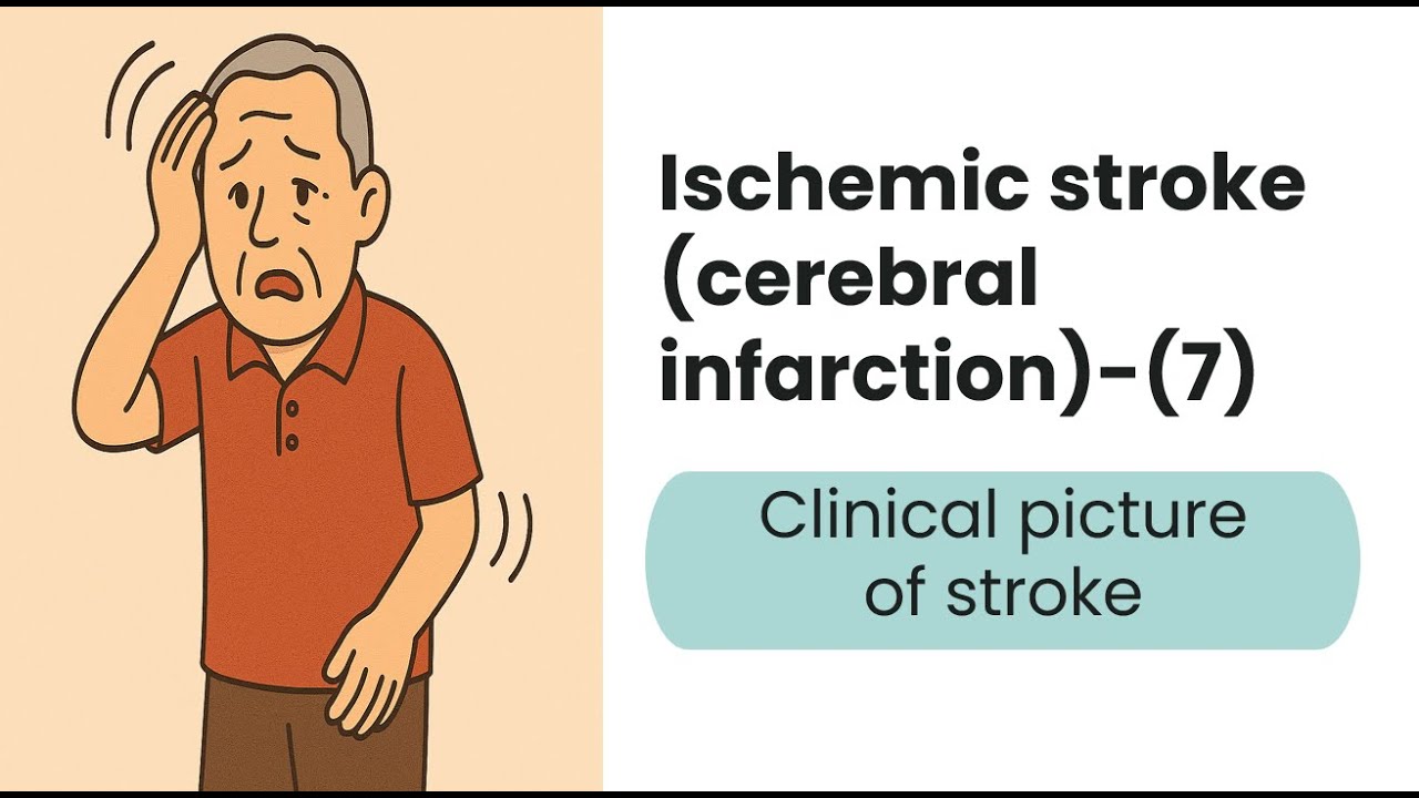 Quiz 104 Ischemic stroke (Cerebral infarction) - (7)