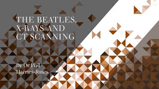 The Beatles, X-Rays and CT Scanning by Dr Phil Harries-Jones