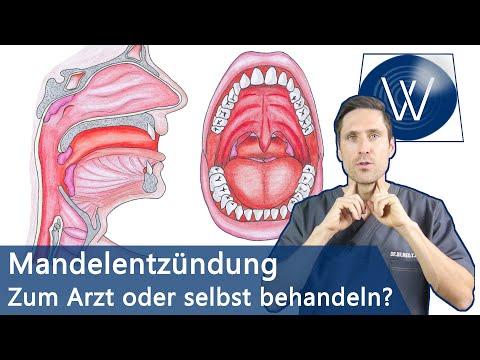 , title : 'Mandelentzündung & Halsschmerzen: Schnell loswerden & Was Sie wissen müssen wenn Sie betroffen sind!'