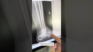 Progressive Spine & Orthopaedics