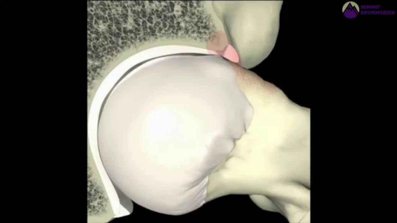 Murilo Oliveira De Almeida-6