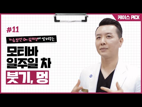 가슴확대수술 후 회복하는데 걸리는 기간은? 수술 후 일주일 붓기/멍/경과 | 윈느성형외과 라벨윈느 유튜브 영상