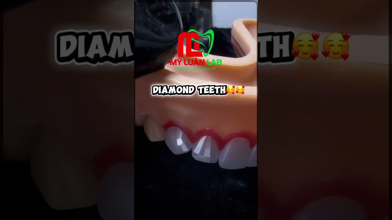 Diamond Teeth - Giải pháp phục hình thẩm mỹ đẳng cấp
